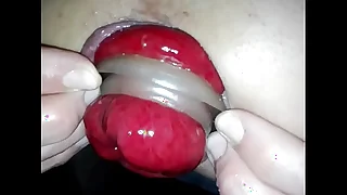 anal-extreme-gay-plug-prolapse-pump-rosebud cheerful prolapse